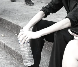 Sophie · 1070 x 1502 Cette photographie en noir et blanc met en scène un jeune homme assis sur des marches. Il est le sujet principal, vêtu d’un pull et d’un pantalon, avec une chaussure noire et une botte orthopédique visible. Le cadrage serré isole ses jambes et ses pieds, créant une composition centrée et intime.La lumière semble naturelle, avec des contrastes marqués. L’ambiance est sobre et mélancolique, renforcée par le monochrome. Le style est documentaire, capturant un moment de quotidien avec simplicité et authenticité.